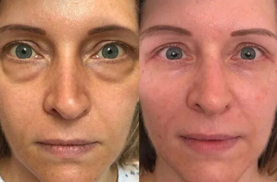 Produktbild 5